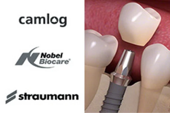 Klasszikus implantálás